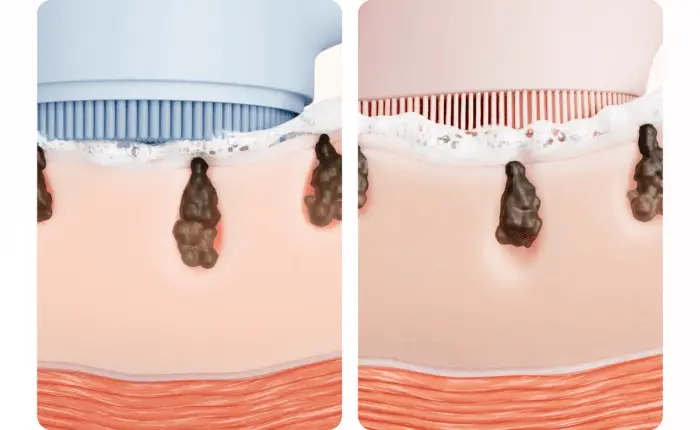 [3D진동클렌징/모공케어] 메디큐브 에이지알 부스터 진동 클렌저 헤드 (베이지/핑크) 상세페이지 51